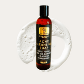Acne Cleansing soap